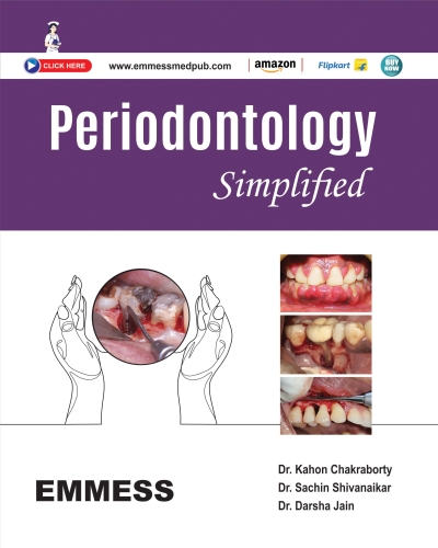 Periodontology  Simplified 